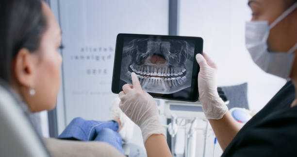 Licensed Tooth Extraction service in Buena Park, CA - Smile Center Dentistry
